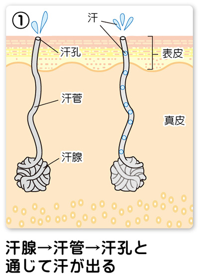 汗疹(あせも) | 足立区西新井駅前の皮膚科 | アース皮ふ科クリニック